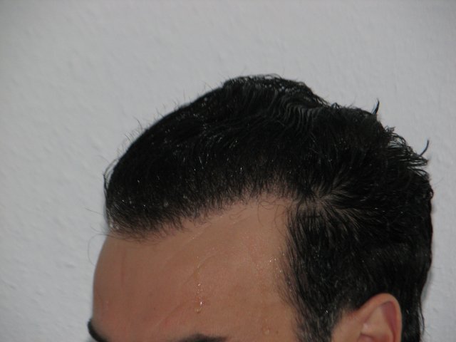8. Nachher