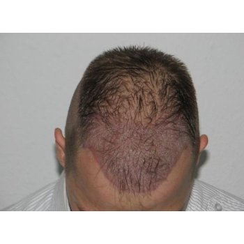 Directly after the operation 