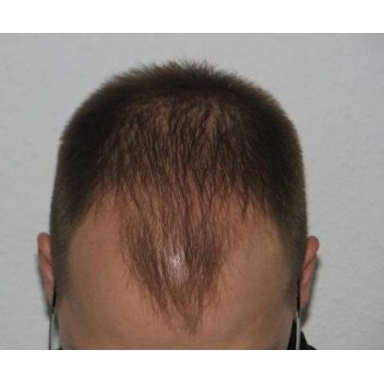 Before the operation 