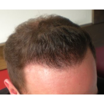 Result 8 months right above