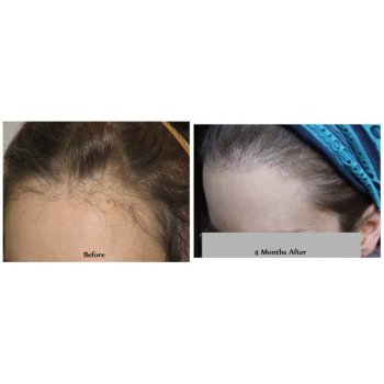 Comparison left