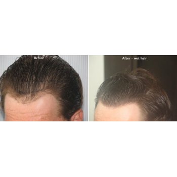 Before and After 1 Before and After 1