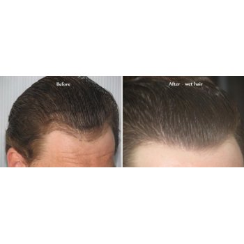 Before and after 2 Before and after 2