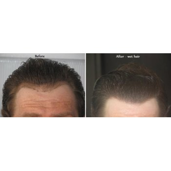 Before and After 3 Before and After 3